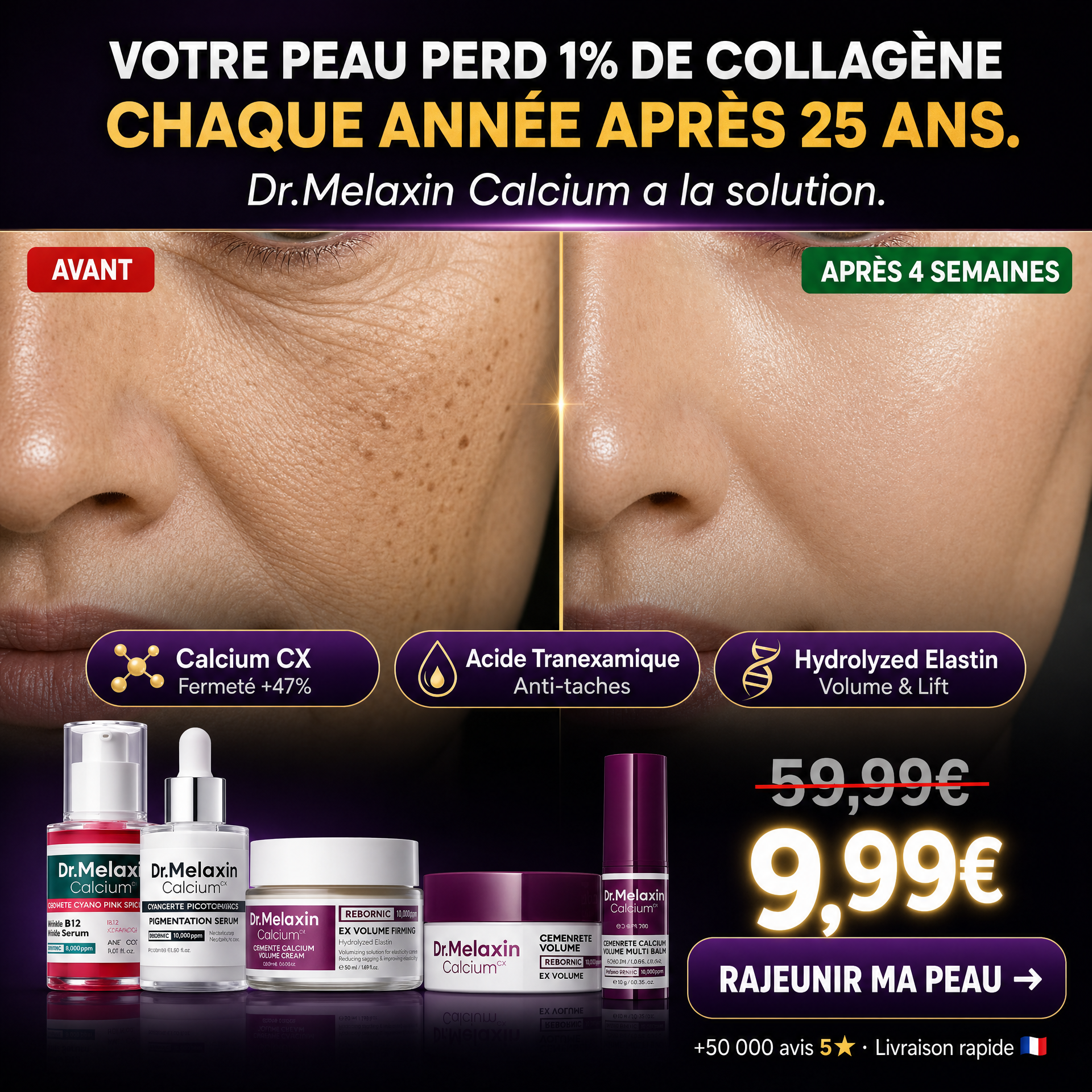 Résultats avant-après Dr.Melaxin en 4 semaines